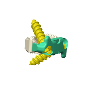 3D Spinal Implants