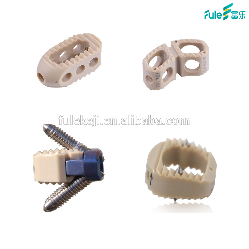 Spinal Fusion Cage Titanium And Peek Orthopedic Implants for Anterior Cervical And Lumber From Beijing Fule 